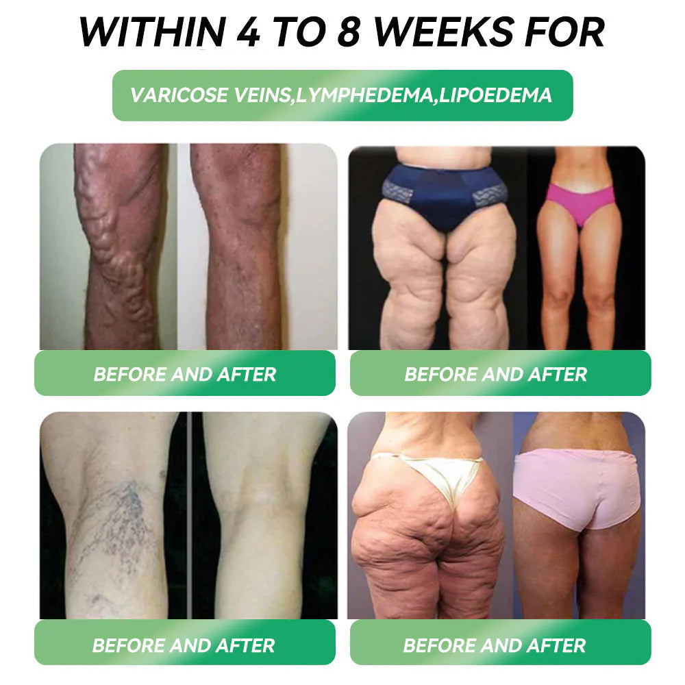 GLP-1 Oral Weight Loss Solution 💎